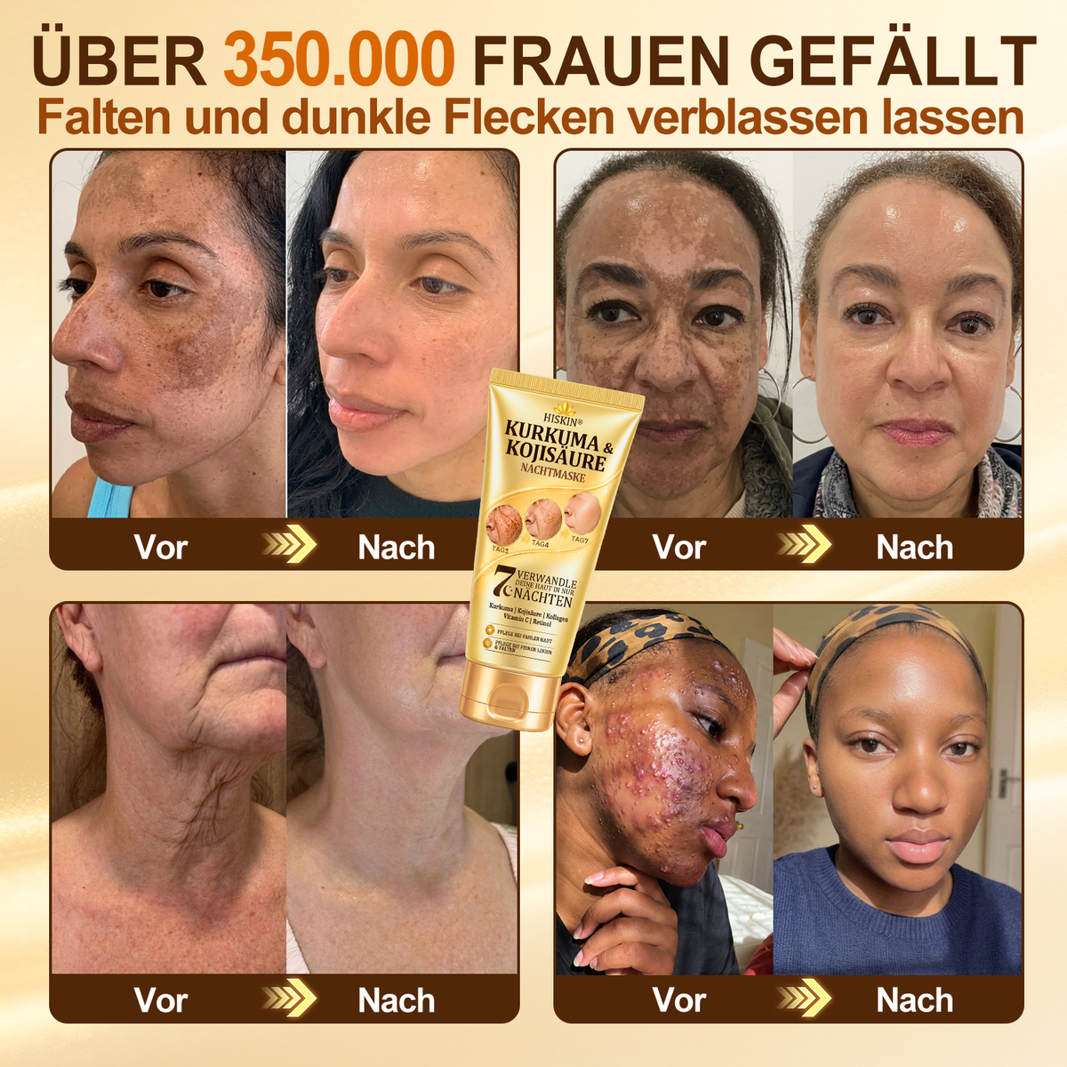 Neu! ✨ Hiskin® Kurkuma × Kojisäure Overnight Peel-Off-Maske – Mildert hartnäckige Pigmentflecken & glättet sichtbare Falten über Nacht 🌙✨ Kurkuma × Kojisäure × Peptid ✅ Nur ein Schritt pro Nacht · Sichtbare Ergebnisse nach 7 Nächten