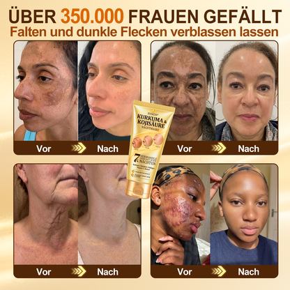 Neu! ✨ Hiskin® Kurkuma × Kojisäure Overnight Peel-Off-Maske – Mildert hartnäckige Pigmentflecken & glättet sichtbare Falten über Nacht 🌙✨ Kurkuma × Kojisäure × Peptid ✅ Nur ein Schritt pro Nacht · Sichtbare Ergebnisse nach 7 Nächten