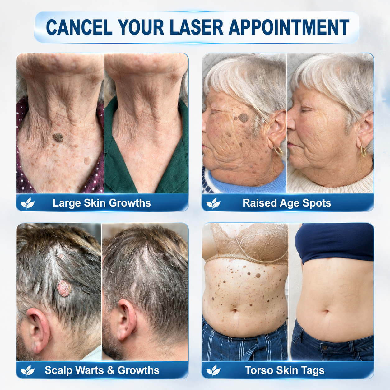 🎁 Only 5 Boxes of 𝐈𝐧𝐬𝐋𝐞𝐦𝐨𝐧® Left! Save an Extra 30% Today – Feel Better Every Day Before This Limited-Time Deal Ends!