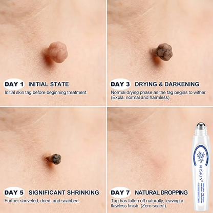 🎁 Only 5 Boxes of 𝐈𝐧𝐬𝐋𝐞𝐦𝐨𝐧® Left! Save an Extra 30% Today – Feel Better Every Day Before This Limited-Time Deal Ends!