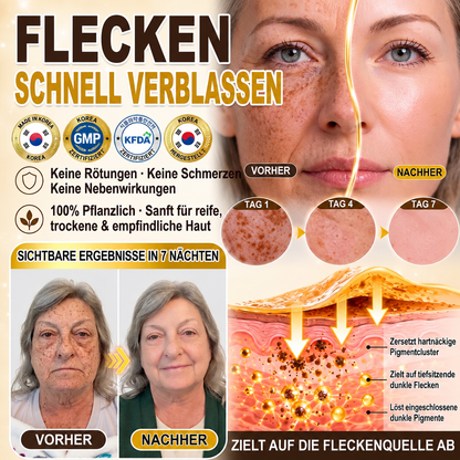 Neu! ✨ Hiskin® Kurkuma × Kojisäure Overnight Peel-Off-Maske – Mildert hartnäckige Pigmentflecken & glättet sichtbare Falten über Nacht 🌙✨ Kurkuma × Kojisäure × Peptid ✅ Nur ein Schritt pro Nacht · Sichtbare Ergebnisse nach 7 Nächten