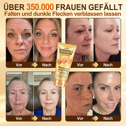 Neu! ✨ Hiskin® Kurkuma × Kojisäure Overnight Peel-Off-Maske – Mildert hartnäckige Pigmentflecken & glättet sichtbare Falten über Nacht 🌙✨ Kurkuma × Kojisäure × Peptid ✅ Nur ein Schritt pro Nacht · Sichtbare Ergebnisse nach 7 Nächten