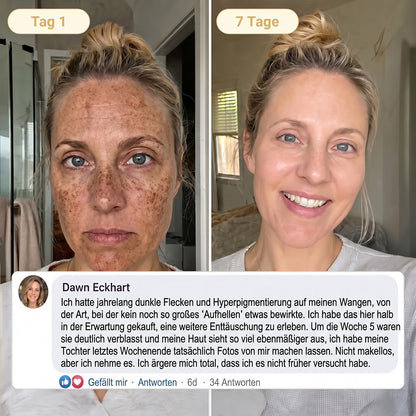 Neu! ✨ Hiskin® Kurkuma × Kojisäure Overnight Peel-Off-Maske – Mildert hartnäckige Pigmentflecken & glättet sichtbare Falten über Nacht 🌙✨ Kurkuma × Kojisäure × Peptid ✅ Nur ein Schritt pro Nacht · Sichtbare Ergebnisse nach 7 Nächten
