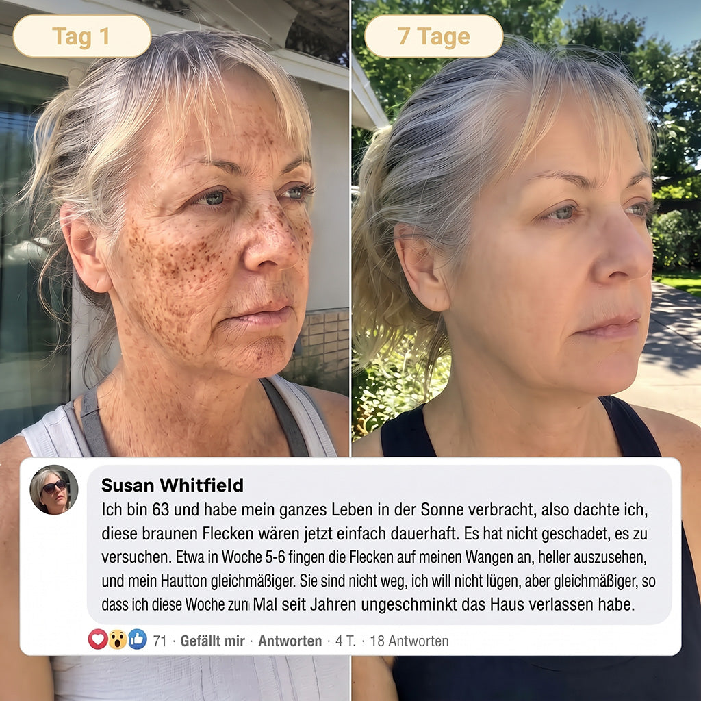 Neu! ✨ Hiskin® Kurkuma × Kojisäure Overnight Peel-Off-Maske – Mildert hartnäckige Pigmentflecken & glättet sichtbare Falten über Nacht 🌙✨ Kurkuma × Kojisäure × Peptid ✅ Nur ein Schritt pro Nacht · Sichtbare Ergebnisse nach 7 Nächten