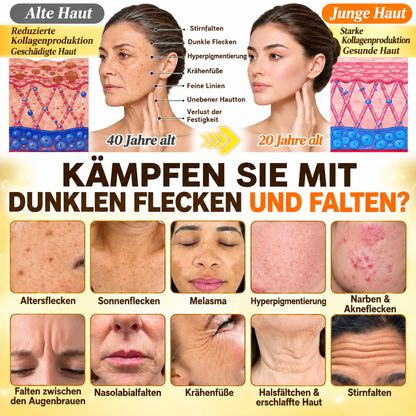 Neu! ✨ Hiskin® Kurkuma × Kojisäure Overnight Peel-Off-Maske – Mildert hartnäckige Pigmentflecken & glättet sichtbare Falten über Nacht 🌙✨ Kurkuma × Kojisäure × Peptid ✅ Nur ein Schritt pro Nacht · Sichtbare Ergebnisse nach 7 Nächten