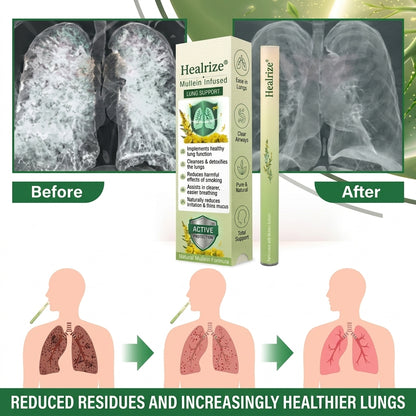 ⏰ Exclusive  Healrize®  Deal Unlocked! Save an Extra 50% Today Only – Claim It Before This Offer Expires!